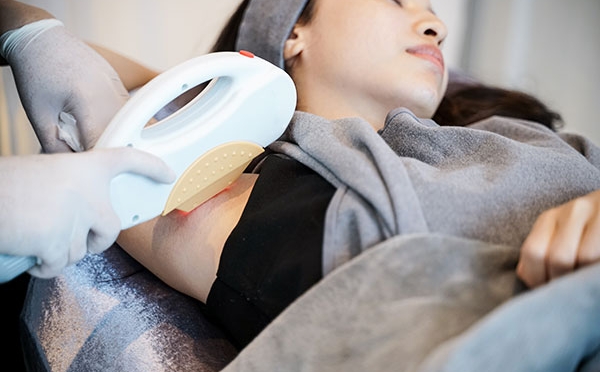 Silky Smooth: Why Should You Consider an IPL Hair Removal