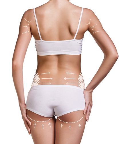 Slim womans body with correction lines on her back. Isolated over white background.